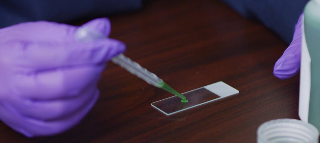 How to get rid of golden algae - lab - water quality testing